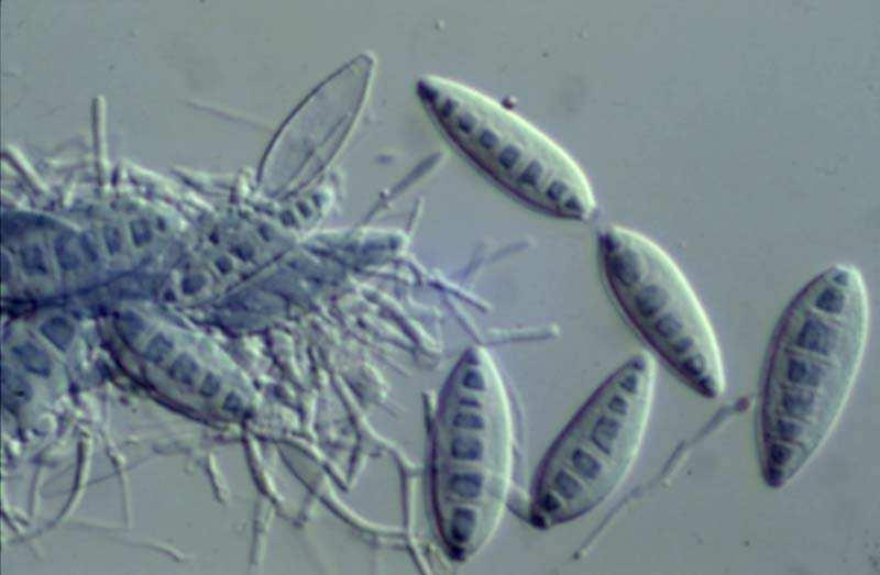 egindako prestakinak erabiliz eta gidan agertutako irudiekin alderatuz, Aspergillus, Microsporum, Trichophyton eta Epidermophyton generoak