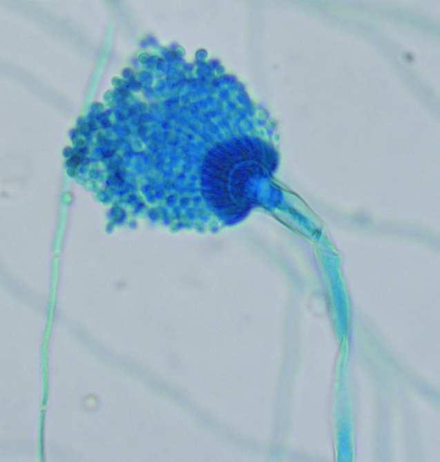 Fitxa honetan landutako kontzeptuak gaitegi teorikoan azaltzen dira: o 30. gaia: «Onddoak eta mikosiak». Bibliografia: Mikrobiologia medikoa. o 27.