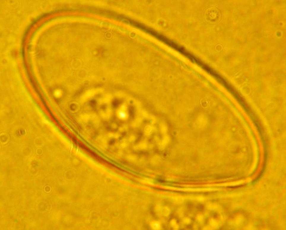 o Ehunetako helmintoen kasuan, Echinococcusaren eta Trichinellaren larbak bereiztea, kiste hidatidikoaren