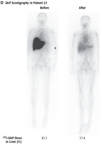 Berk et al. JAMA 2013; Richards et al. NEJM 2015; Adams et al.