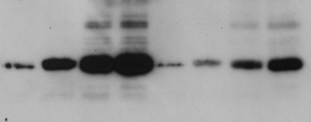 (cbx3+/-/wt, ±SD) B IL-2 10 U/ml