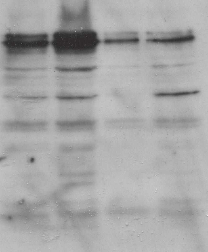 0 cbx3+/- WT cbx3+/- CD3/28 CD3/28 CD3/28 IL-2