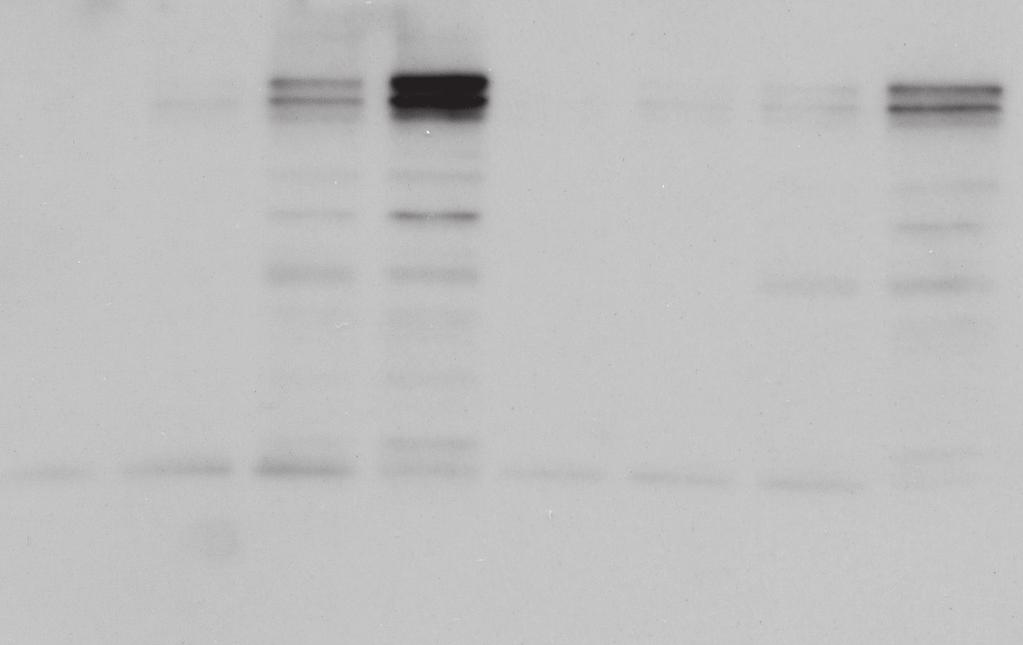 250 75 50 CD8+ T cells WT cbx3+/cd3/28 CD3/28 0