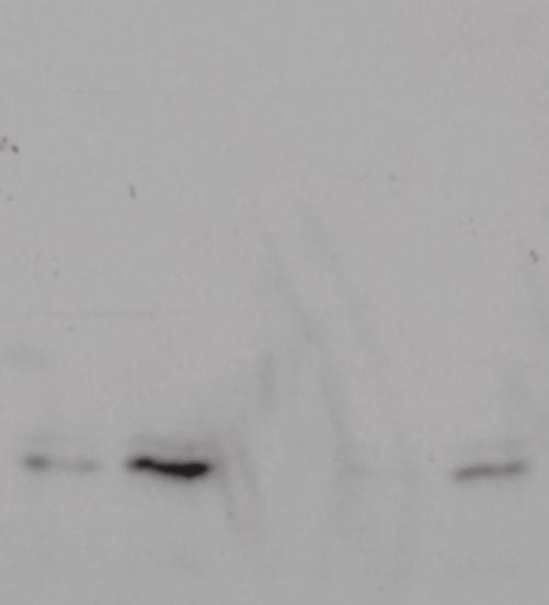 1 hr T-bet 25 10 E kda 250 Day 5 CD8+ T cells