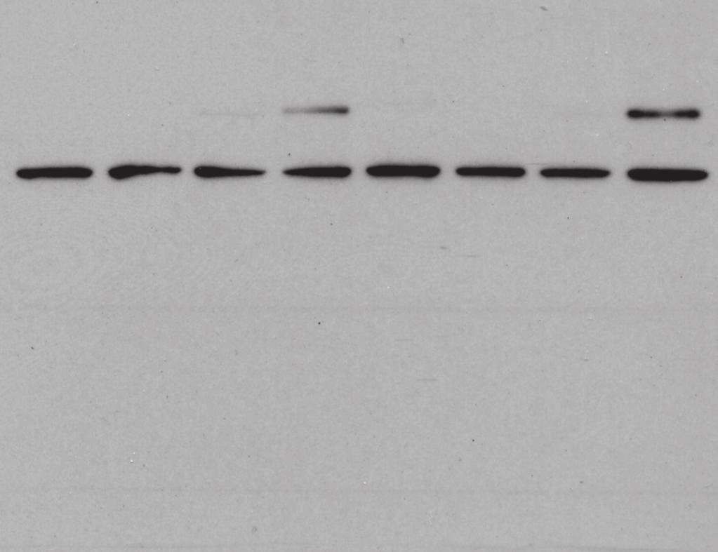 250 20 15 10 Cleaved caspase 3 17/19 kda CD4