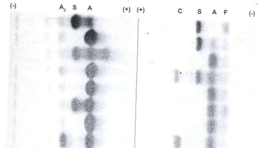 Αλκαλική ηλεκτροφόρτηση (ph 8,6) Όξινη ηλεκτροφόρηση (ph 6,2) Εικόνα 12Β. Ηλεκτροφόρηση δειγμάτων αιμοσφαιρίνης σε αλκαλικό και όξινο ph 2.3.