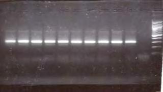 3. Αλυσιδωτή αντίδραση πολυμεράσης (Polymerase chain reaction, PCR) Η αλυσιδωτή αντίδραση πολυμερισμού (Polymerase Chain Reaction, PCR), είναι μια δυναμική μέθοδος στον τομέα της μοριακής βιολογίας