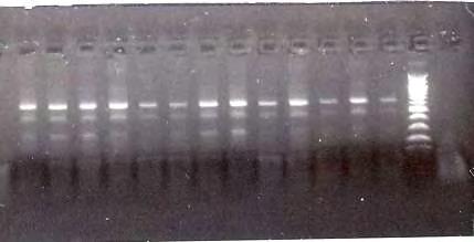 διαλύματος DNA και ο όγκος συμπληρώνεται με dd H 2 O ώστε να έχουμε τελικό όγκο 100 μl (προσθέτουμε δηλαδή 65,5 μl dd H 2 O). 4.