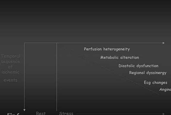 Ischemic Cascade Classical Alternative Stress