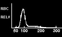 Εύρος κατανομής του όγκου των ερυθρών (RDW, Red cell Distribution Withd)