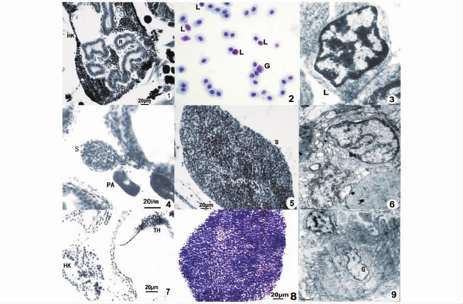 4 12 613 1. 60 HK R 2. 10 L G 3. L 4. 7 S PA 5. 41 S 6. Mo 7. 10 TH HK 8. 12 TH 9. L G HK. R. L. GR.. S. PA. Mo. TH. Plate The immune organs of L. crocea 1.