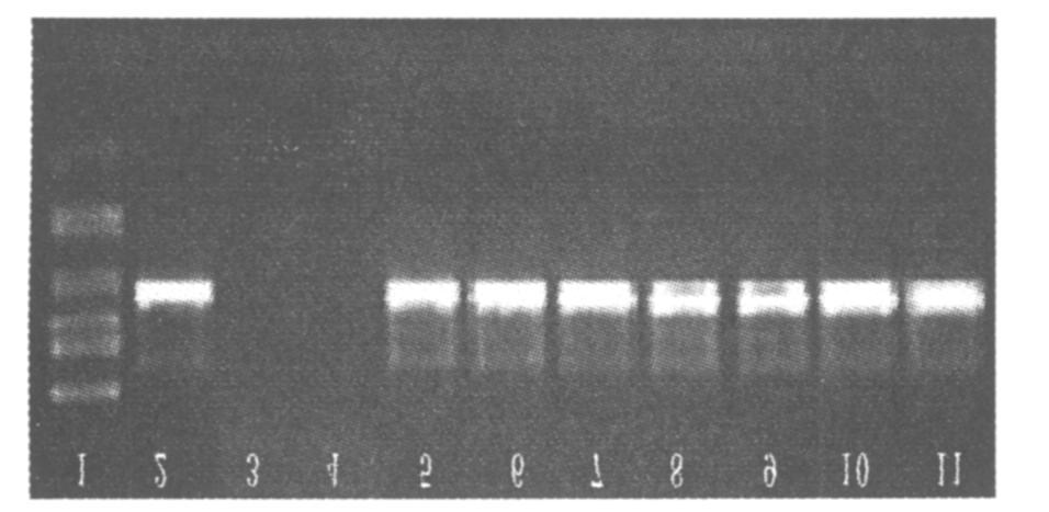 224 () 2008 1 HBV Fig. 1 Analysis of virus2neutralizing ability of HBV spe2 cific antibody in vitro 1. 2000DL Marker ;2. Dane paricle ;3. H EV mab E1 ; 4. H EV mab E2 ; 5.