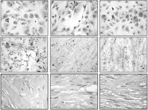 () (Von Kossa ) ( O ) 1 [44] 3 O 3 3 Von Kossa 3 3 50 µm [32-33] [34-35] [36-37] [38-39] [40] [41] Li [42-44] (
