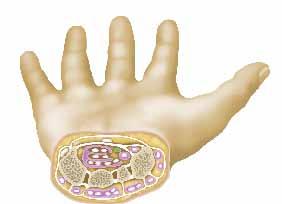 Πρόκειται για μακριές δομές σαν «κορδόνια» που συνδέουν τους μυς που βρίσκονται στον πήχη με τα οστά των δαχτύλων του χεριού.
