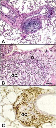 Εικόνα 29: Ιστολογικές τομές πνευμόνων μικρών παιδιών που αναδεικνύουν τον λεμφικό ιστό των βρόγχων (bronchus associated lymphoid tissue ή BALT).