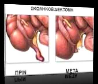 ρεηξνπξγηθά: Με