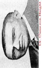 Ζζημνηθά ημηπεία 1941 Πξώηε επηηπρήο επηδηόξζωζε Αξηζηεξή πιεπξηθή πξνζέγγηζε Πξωηνγελήο κνλή αλαζηόκωζε In recent years there has been