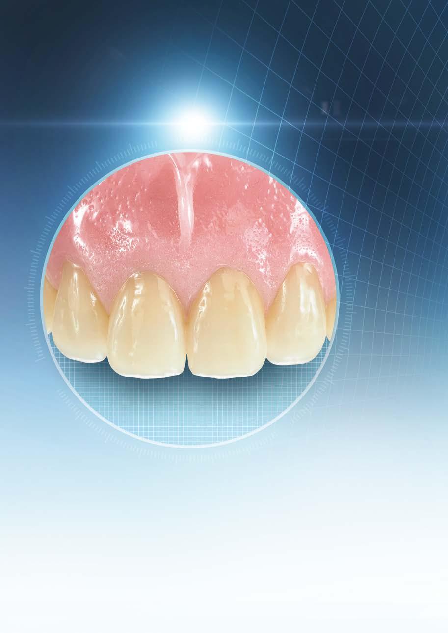 ΣΧΕΔΙΑΣΗ ΒΑΣΙΣΜΕΝΗ ΣΤΟ ΦΥΣΙΚΟ ΔΟΝΤΙ VITAPAN EXCELL:Το δόντι οδοντοστοιχίας για ιδανική διαμόρφωση μεσοδόντιου διαστήματος/θηλής