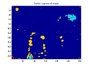 s 3 s r t t t t 1 r t r Measurements Artificial energy excitation Registration of surface temperature Simulations Simulation of phase and amplitude contrast images Observation of defects