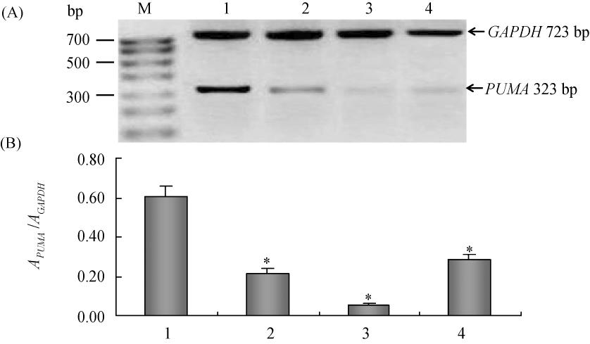 674 27 Fig 2 PUMA expression in cardiomyocytes transfected with various concentrations of si-puma detected using RT-PCR Various concentrations of PUMA targeted sirna were transfected into primary