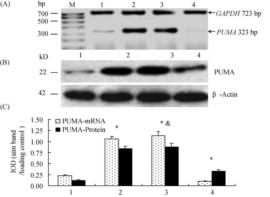 7 PUMA sirna / 675 si-puma caspase-3 Bcl-2 2 97 ± 0 25 H / R 6 h P < 0 01 si-scr H / R 6 h caspase-3 P > 0 05 2 6 si-puma H / R 18 RNAi PUMA sirna PUMA Fig 6 H / PUMA R Bax mrna Bcl-2 mrna si-puma