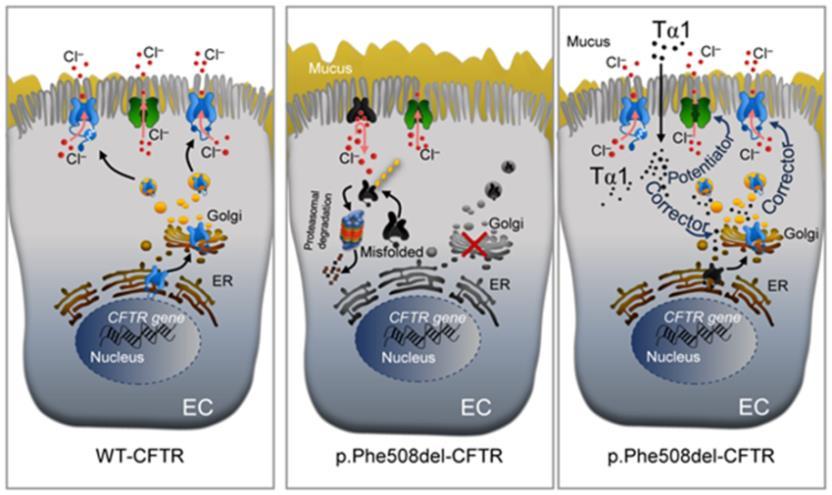 Thymosin α1 represents a potential potent single-molecule-based therapy for cystic fibrosis Μείωση φλεγμονής Αύξηση ωρίμανσης,