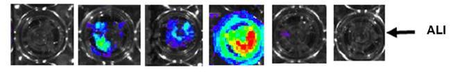 Preparation for a first-in-man lentivirus trial in patients with