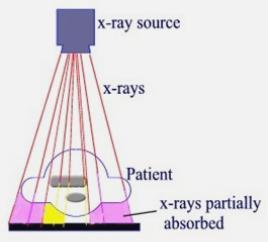 σχηματισμός εικόνας λυχνία ακτίνες Χ θέμα ολική απορρόφηση μερική εξασθένηση δέσμης εικόνα: περιοχές IR που δεν δέχονται