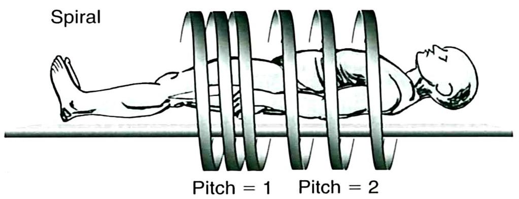 που χρησιμοποιούμε στο πειραματικό μέρος της εργασίας μας βασίζονται στην ελικοειδή σάρωση. Εικόνα 7: ελικοειδής σάρωση (spiral CT).