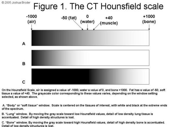 pixel) αντιστοιχεί σε μία τιμή ενός ιδεατού μεγέθους, το οποίο ονομάζεται Hounsfield Unit, (HU) ή CT number.