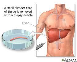 Reference Standard Test, series of tests, or set of procedures that is used to determine the presence or absence of the target condition Gold standards with 100% sensitivity and specificity are rare