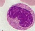 Μονοκύτταρα Φυσιολογικά 200-900 (median 450) Αυξηµένα µονοκύτταρα ρικέτσιες κάποιες