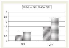 FFR of the culprit and myocardial recovery 46 patients recent MI (mean=3.