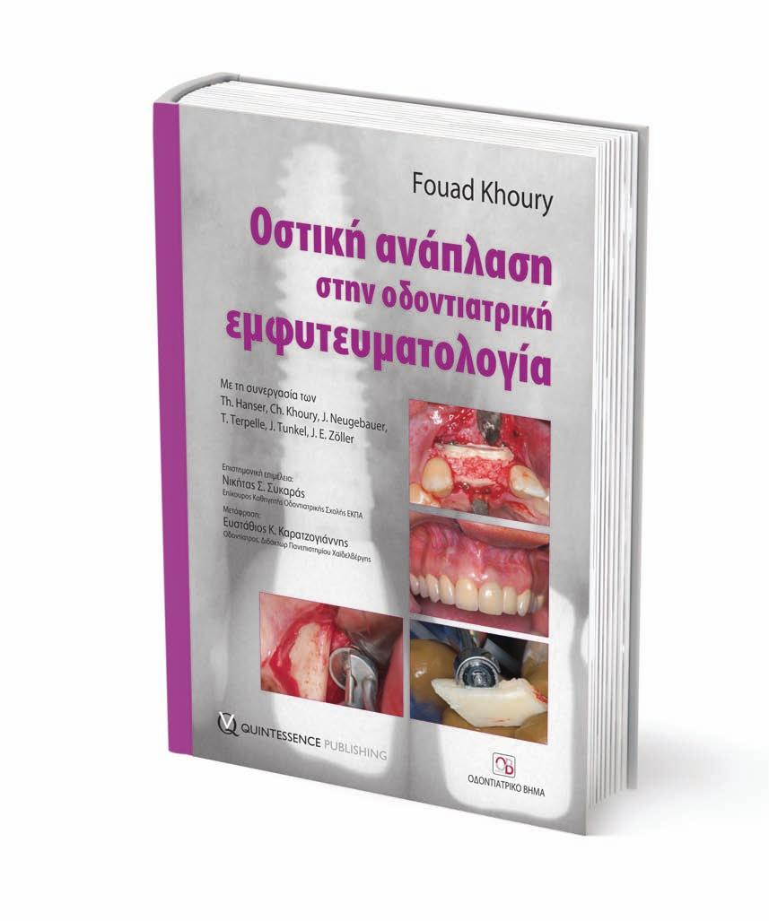 Οστική ανάπλαση στην οδοντιατρική εµφυτευµατολογία Το παγκόσµιο best seller του Fouad Khoury τώρα και στα ελληνικά Επιστηµονική επιµέλεια: Νικήτας Σ.