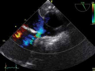 8th INNOVATIONS IN INTERVENTIONAL CARDIOLOGY & ELECTROPHYSIOLOGY / IICE 8ο ΣΥΝΕΔΡΙΟ ΕΠΕΜΒΑΤΙΚΗΣ ΚΑΡΔΙΟΛΟΓΙΑΣ & ΗΛΕΚΤΡΟΦΥΣΙΟΛΟΓΙΑΣ ΠΕΡΙΛΗΨΕΙΣ ΕΡΓΑΣΙΩΝ ΗΛΕΚΤΡΟΦΥΣΙΟΛΟΓΙΑΣ ΠΑΡΑΣΚΕΥΗ 11 ΣΕΠΤΕΜΒΡΙΟΥ 2015