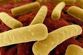 Τοξινογόνο Clostridium difficile Το τοξινογόνο Clostridium difficile αποτελεί σημαντικό αίτιο διάρροιας, την οποία παρουσιάζουν συχνότερα οι ηλικιωμένοι.