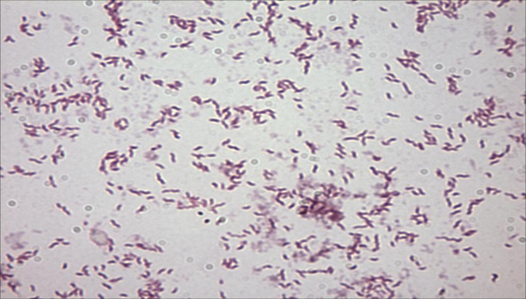 Cambylobacter με Gram