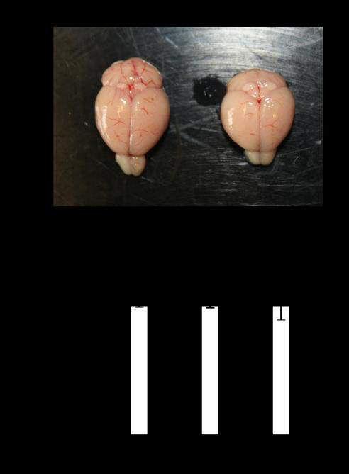 Supplementary Figure 3. Brain morphology in Nono gt mice.