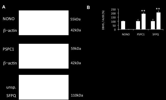 (a) Western blots of hippocampal protein extracts from widtype and Nono gt mice