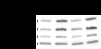 Langouët et al., Human Mutation 5 Supp. Figure S2. TTI2 silencing in HEK293 cells.