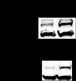 After 2 days, cells were harvested and knockdown of TTI2 mrna expression was confirmed by RT-qPCR.