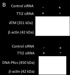 anti-tel2 and anti-β-actin antibody (A) or with anti-atm and anti-dna-pkcs antibody (B).