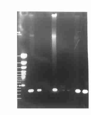 522 7 9 Table Results of samples tested by PCR and virus isolation 989 6 996 2 5 PRV PCR + - Virus isolation + - 7 0 0 7 Table 2 Results of samples tested by PCR and the Sandwich ELISA PCR + -