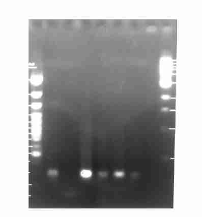 strain ; I :F2 strain 25 PCR ELISA 2 994998 6 67 PCR ELISA 2 Table 2PCR 463 % (3Π67) ELISA 343 % (23Π67) x 2 ( P 005) 2 PCR ELISA 26 PCR 9992000 3 9 PCR 50 262 % (50Π9) ; 22 7 %(22Π3) Fig 3 Fig 2