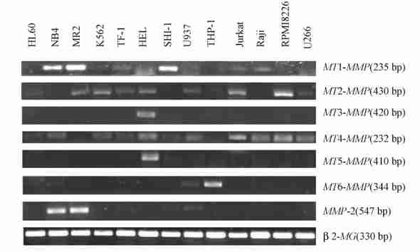 7 : 22 577 NB 4 MR 2 HL260 K562 HEL THP21 4 MMP22, RT2PCR MMP22, RT2PCR Fig 2 Electrophoresis of RT2PCR products of 6 MT2MMPs and MMP22 in 13 human hematopoietic cells The specific PCR products were