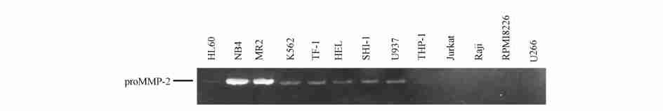 hematopoietic cells Serum2free supernatants from 13 cells were studied by gelatin zymography in a 715 % acrylamide gel containing 1 mgπml gelatin under nonreduced conditions Gelatinolytic activity at