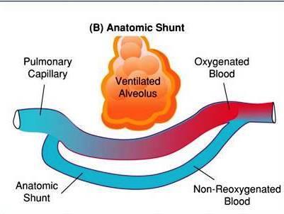 Shunt Το μη οξυγονωμένο αίμα δεν έχει