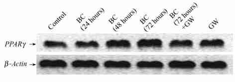 6 : 2 MCF27 (PPAR ) 545 Fig. 1 Effect of 2carotence on the PPAR mrna level ( GW9662), an inhibitor to PPAR, was used by 5 molπl.