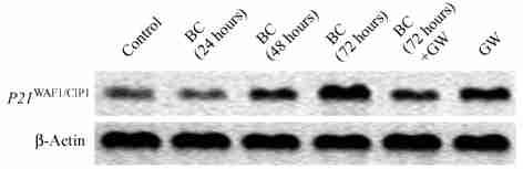 Data are expressed as Table 7 Effect of 2carotene on the P21 WAF1ΠCIPl mrna level Treatment Control BC(24 hours) BC(48 hours) BC(72 hours) BC(72 hours) + GW GW P21 mrna level 1 0. 971 0. 053 1. 211 0.