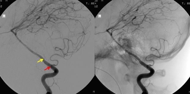 MEDULLARY